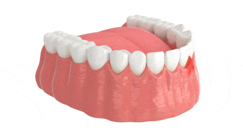 Tratamiento de la enfermedad periodontal en Melbourne-FL-Diseño-Smiles-Dr.-Victor-Apel