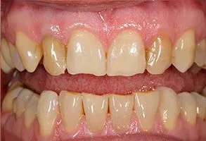 Designing Smiles Dentistry | Odontología Cosmética en Melbourne, FL | Dr. Victor Apel