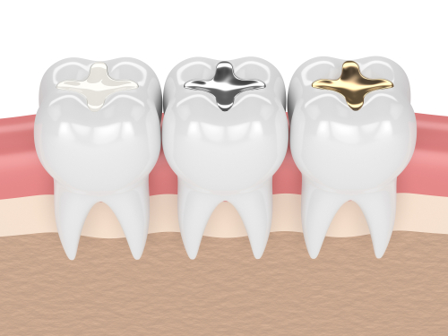 Tooth Extractions in Melbourne, FL Designing Smiles Dr. Victor Apel