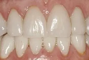 Designing Smiles Dentistry | Cosmetic Dentistry in Melbourne, FL | Dr. Victor Apel