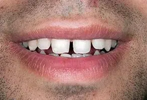 Designing Smiles Dentistry | Cosmetic Dentistry in Melbourne, FL | Dr. Victor Apel