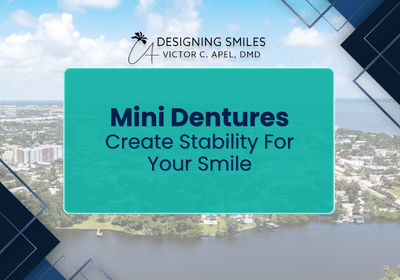 Mini Dentures in Melbourne, FL | Book a Complimentary Consult!