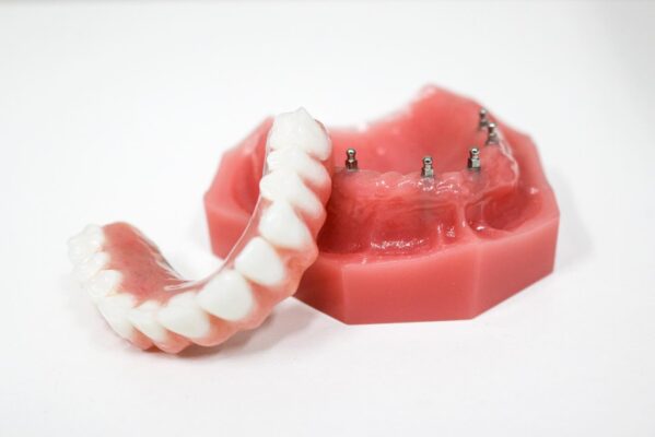 Full Arch Dental Implants in Melbourne, FL | Free Consultations