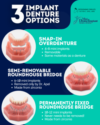 Prótesis dentales en Melbourne, FL | Opciones de implantes a precios accesibles | Opciones de prótesis sobre implantes