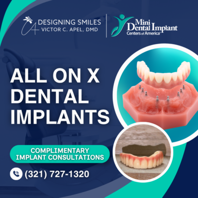 All on X in Melbourne, FL | Complimentary Implant Consultations