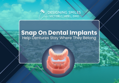 Implantes dentales Snap On | Prótesis dentales a precios accesibles en Melbourne, FL 1