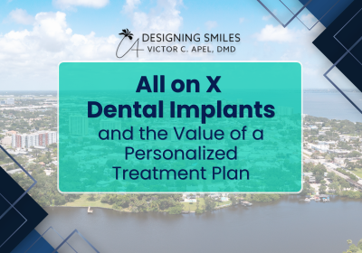Todo sobre los implantes dentales X en Melbourne, Florida | Financiamiento disponible